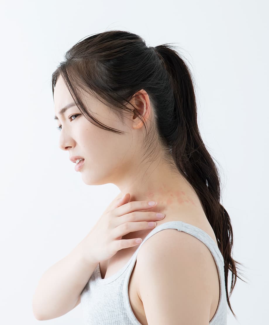 フジイ薬局へのアトピー性皮膚炎のご相談